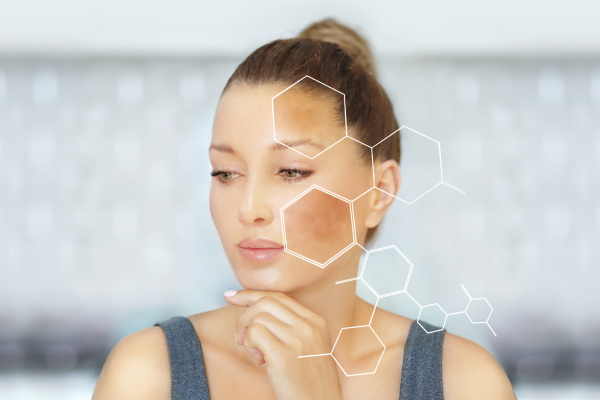 tinh dầu trị nám tàn nhang